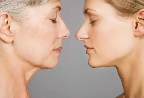 Laser facial wrinkle removal before and after