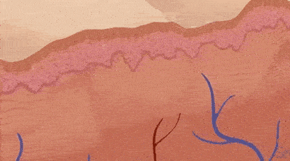 Fractional laser skin treatment animation