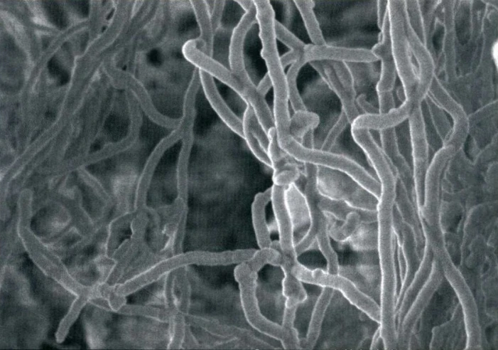 Schematic diagram of collagen fibers