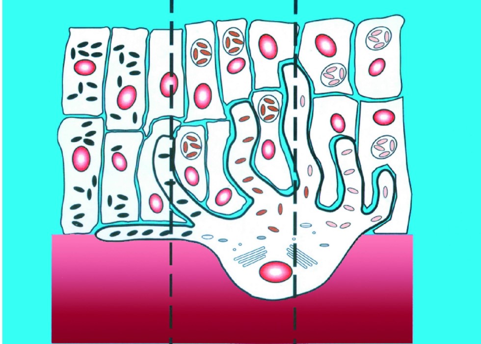 Differences in melanosomes among people with different skin colors