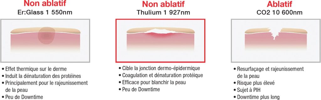Comparison between thulium laser and CO2 laser and Erbium Glass laser