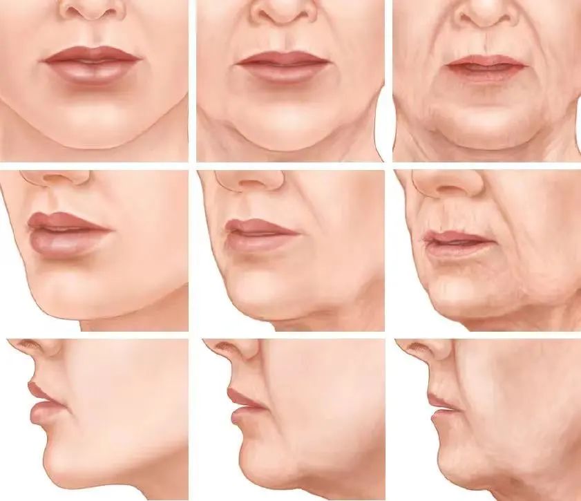 Sagging facial skin photos