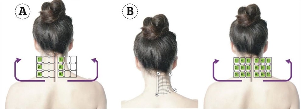 Thermage 360° Neck Lift Introduction Picture