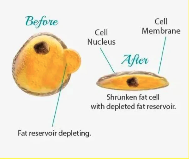 Coolsculpting fat dissolution diagram