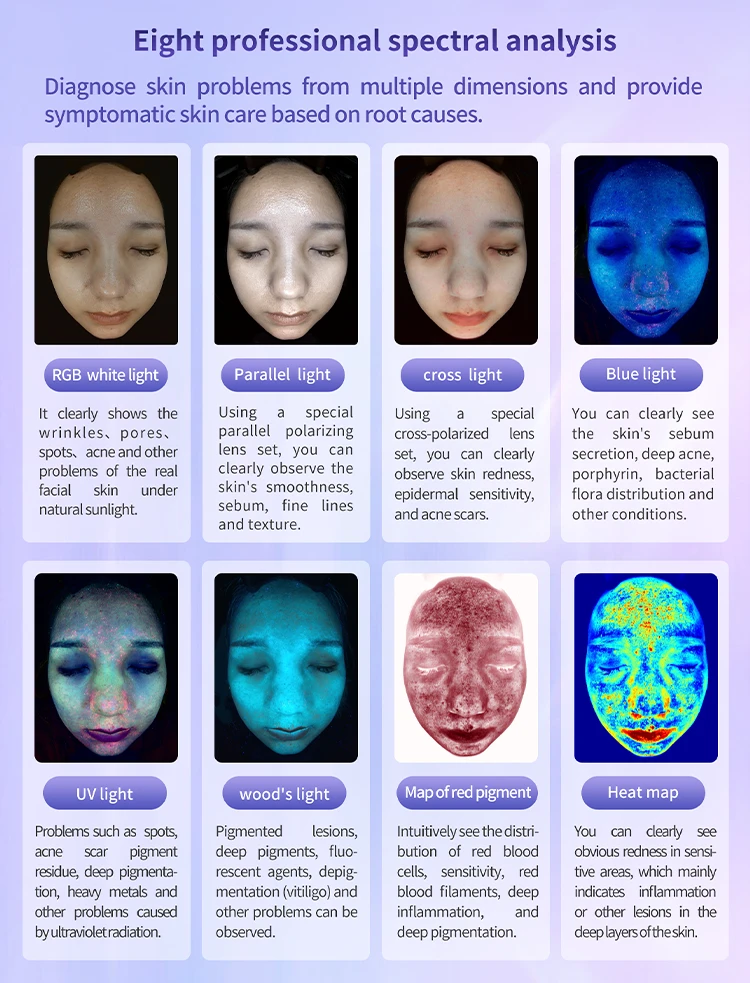 Skin analyzer uses 8 spectrum analysis