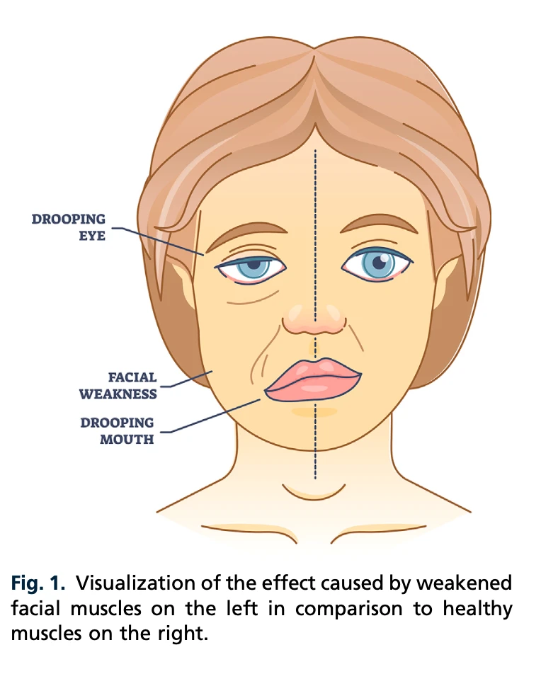 Animated comparison of facial muscle tightening and relaxation