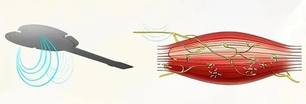 EMface working principle diagram