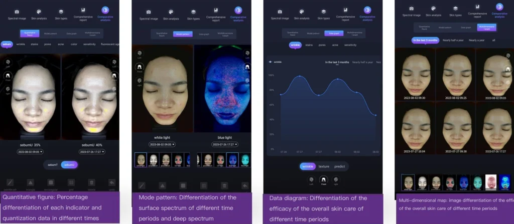 Skin Analysis Report Case - Liton Laser