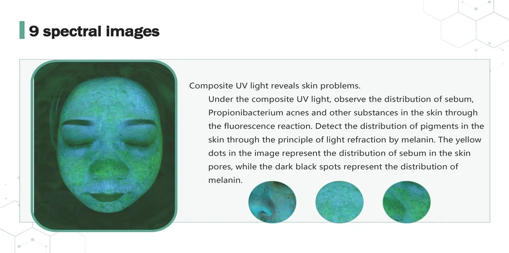 Skin Analyzer 9 Spectrum Composite UV light