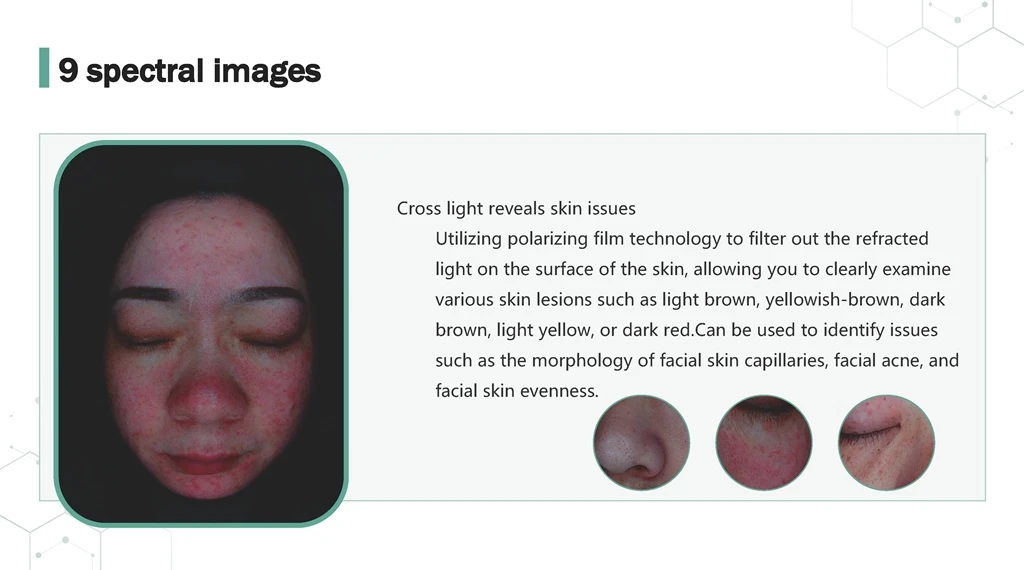 Skin Analyzer 9 Spectrum Cross Light