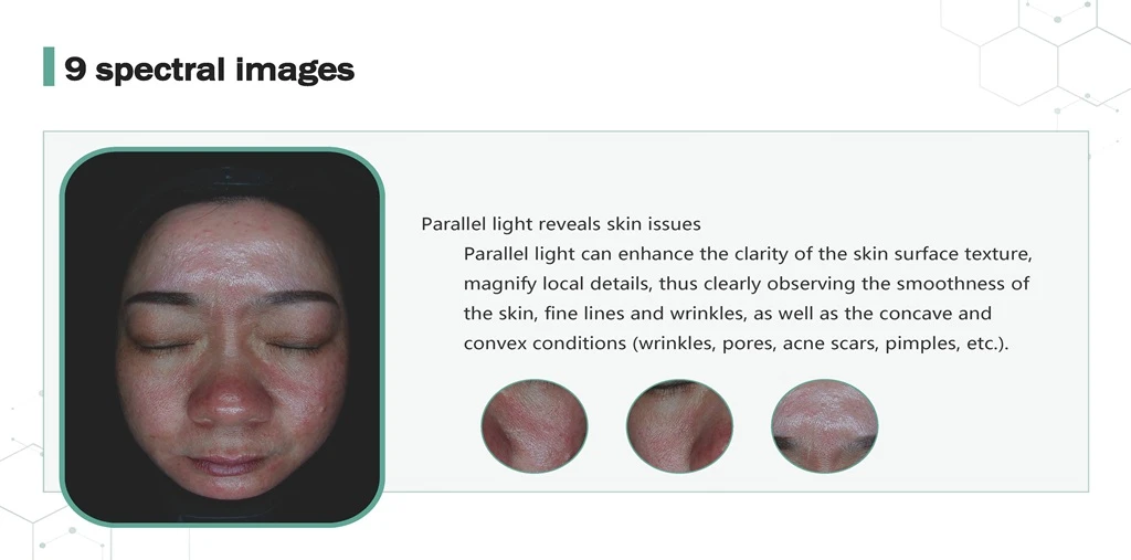 Skin Analyzer 9 Spectrum Parallel Light
