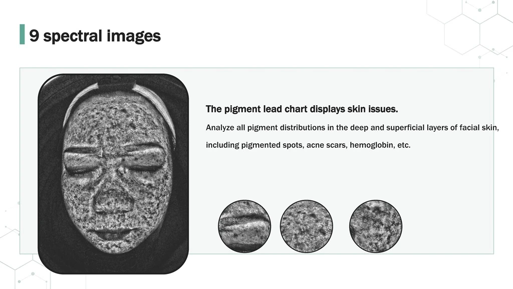 Skin Analyzer 9 Spectrum Pigment Lead Image