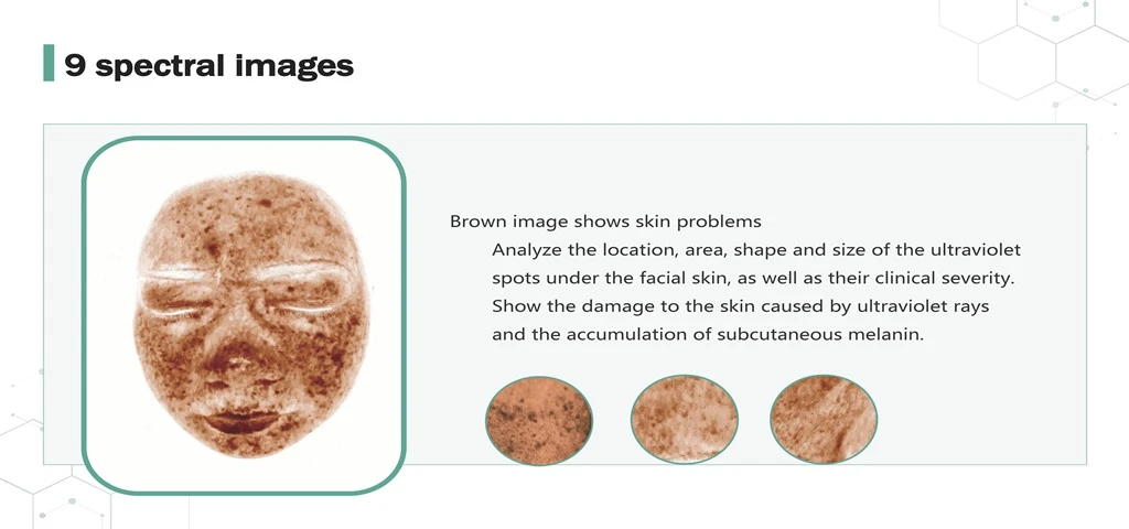 Skin Analyzer 9 Spectrum RBX Brown Chart