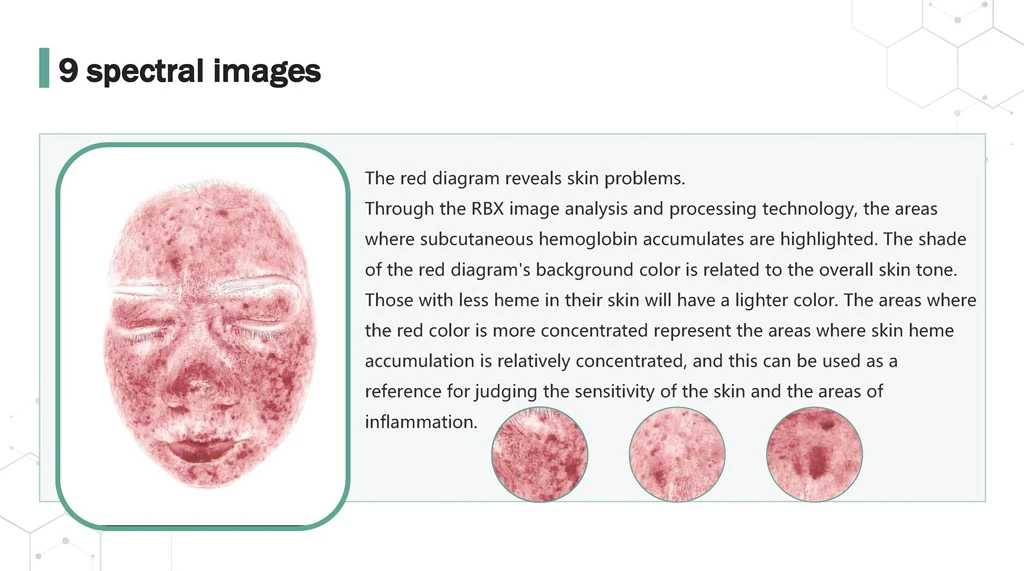 Skin Analyzer 9 Spectrum RBX Red Chart