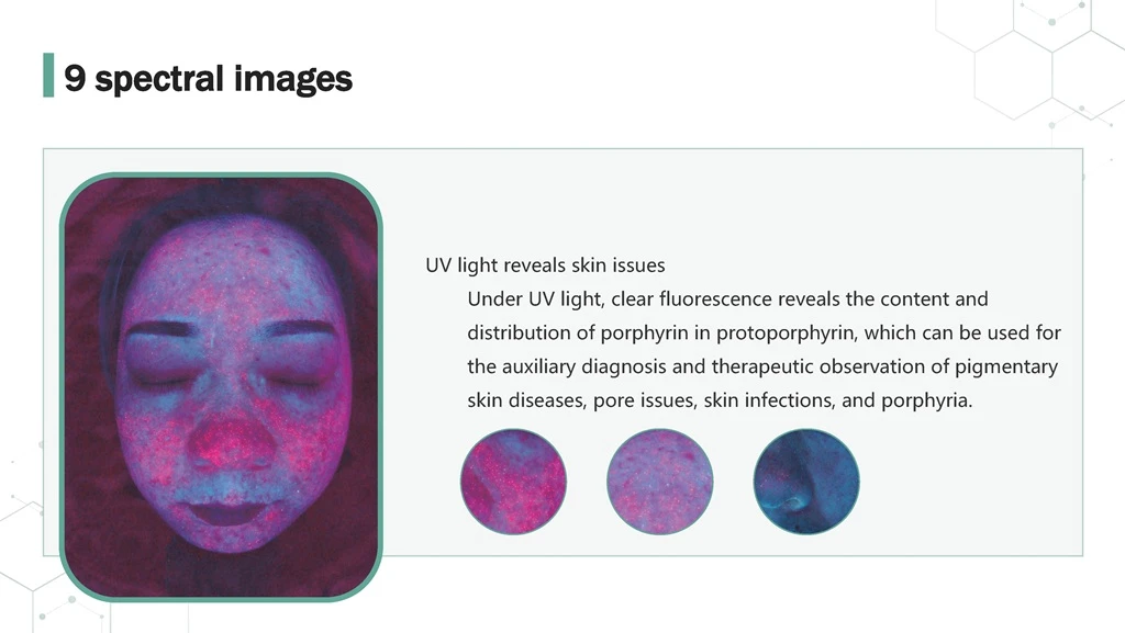 Skin Analyzer 9 Spectrum UV Light