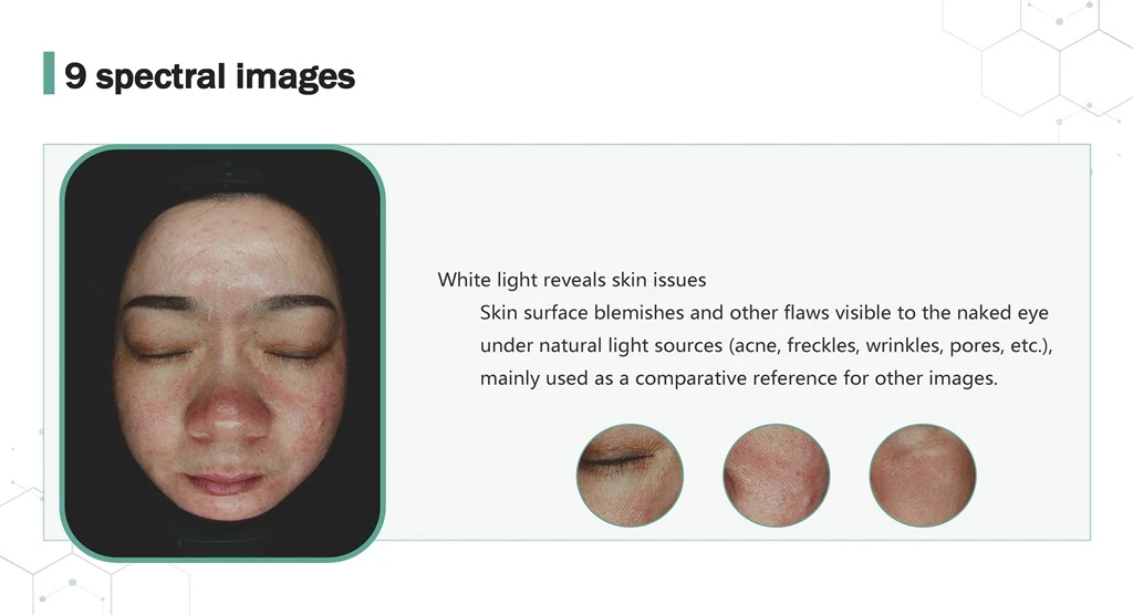 Skin Analyzer 9 Spectrum White Light