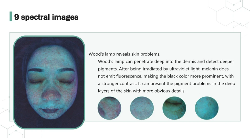 Skin Analyzer 9 Spectrum Wu's Light