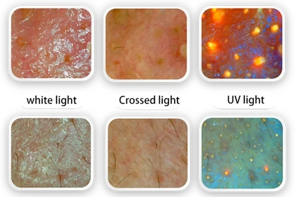 Skin analyzer microscopic examination photo