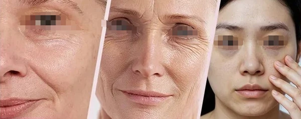 Facial wrinkle classification