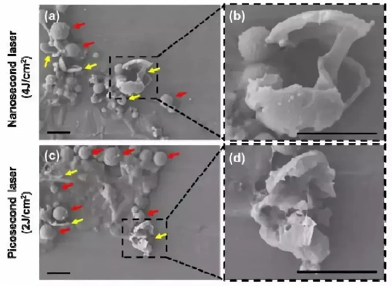 Nanosecond and picosecond lasers burst pigment