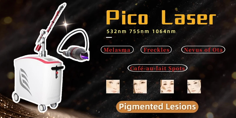 Pico laser treatment for pigmented lesions